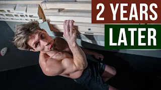 Hangboard Training 2 times per day for 2 years