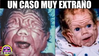 6 Nacimientos de Bebes Más Extraños Del Mundo