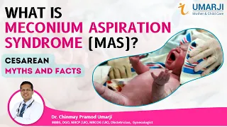 Cesarean Myths and Facts | Meconium Aspiration Syndrome - Dr. Chinmay Umarji