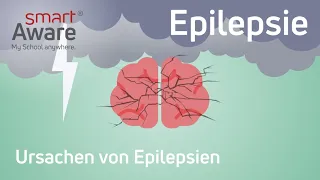 Epilepsie: Ursachen von Epilepsien | Fachfortbildungen Pflege | Fortbildung Pflege | smartAware