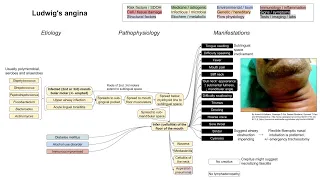 Ludwig's angina (mechanism of disease)