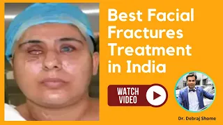 Facial Fractures Treatment in India- Oculoplastic, Maxillofacial & other Multidisciplinary Approach