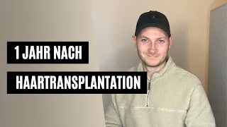 Ergebnis nach 1 Jahr - Haartransplantation Türkei