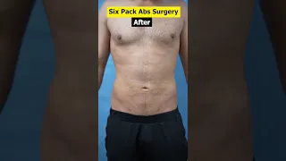 Six Pack Abs | 6 Pack Abs result #shorts #viral