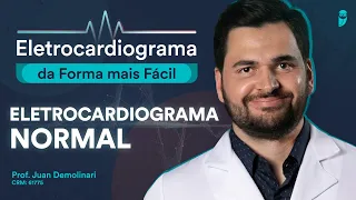 Eletrocardiograma Normal - Eletrocardiograma da Forma mais Fácil