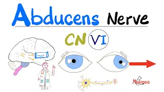 Abducens Nerve - Cranial Nerve 6 (CN VI) - Cavernous Sinus Syndrome, Pseudotumor cerebri