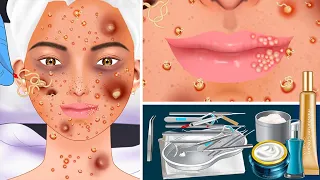 ASMR treatment of acne and freckles on a teenage girl's face - 십대 소녀의 얼굴에 여드름과 주근깨 치료