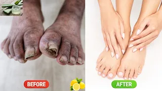 How to brighten your feet and clean your nails in 5 mins#nails #acrylic #reelsinstagram