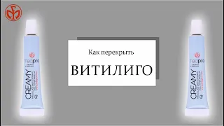 Как перекрыть витилиго?