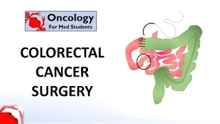 Colorectal Cancer Surgery: principles and types