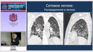 И.Е. Тюрин - Идиопатические интерстициальные пневмонии