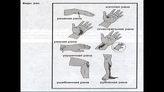"Безопасность жизнедеятельности" "Виды ран, транспортировка и оказание первой первой помощи"