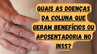 INSS: QUAIS DOENÇAS DE COLUNA DÃO DIREITO A BENEFÍCIO