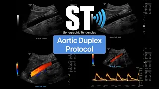 Aorta Duplex (Doppler) Protocol