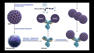 Guillain-Barré Syndrome | Mechanism & Presentation