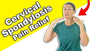 Want to Relieve Cervical Spondylosis Pain? These Stretches May Help!