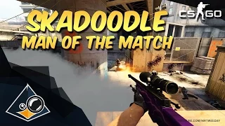 CS:GO - Skadoodle - Man of the Match