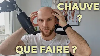 Chauve et comment y survivre en 2023 : conseils pour la perte de cheveux