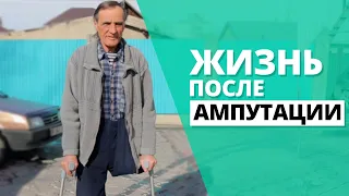 Жизнь после ампутации. Николай Беленький