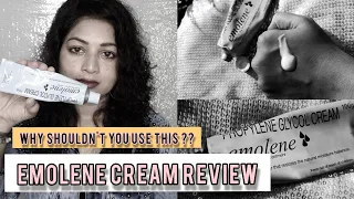 EMOLENE CREAM REVIEW| All you need to know about EMOLENE CREAM