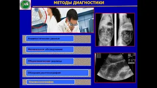 видеолекция НЭК у новорожденных