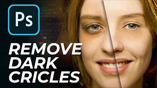 How to Remove Dark Circles in Photoshop | Naturally Remove Dark Circles | 1 Minute Photoshop