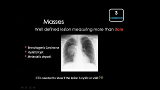 10. Chest Imaging Focal Lung Lesions, Dr. Mamdouh Mahfouz