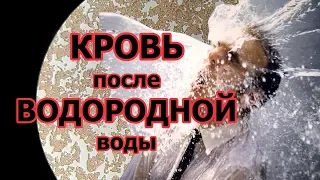 Кровь после ВОДОРОДной воды