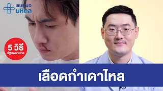 5 วิธีปฐมพยาบาลเมื่อเลือดกำเดาไหล | พบหมอมหิดล