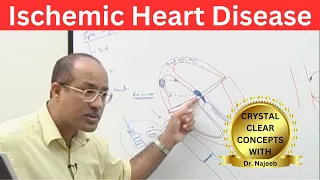 Ischemic Heart Disease | Myocardial Infarction | Cardiology🫀