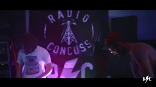 Scallops Hotel // Milo // Kenny Segal // Randal Bravery // SB the Moor - Radio Concuss Promo