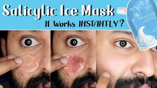 Viral Salicylic Ice Mask Review | Shadhik Azeez | Tamil | English Subtitles