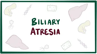 Biliary atresia - causes, symptoms, diagnosis, treatment & pathology
