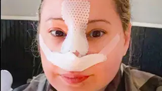 Gypsy Rose Blanchard Becomes Unrecognizable After Major Nose Job