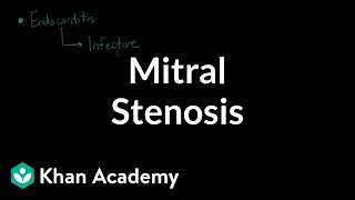 Mitral stenosis | Circulatory System and Disease | NCLEX-RN | Khan Academy