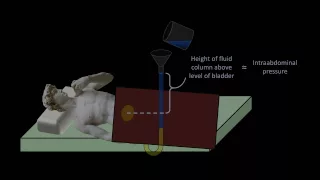 Hydrostatic Pressure - Medical Applications (Fluid Mechanics - Lesson 4)