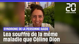 Comme Céline Dion, Lea souffre du syndrome de la personne raide