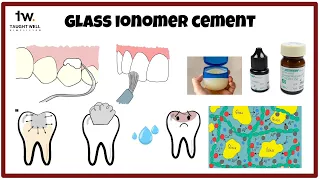 Glass ionomer cement simplified!