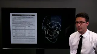 1.2 Overview of Overdentures for Edentulous Mouths (Questions 13-22) - Dr. Mark Durham