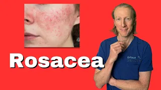 Your Guide to Rosacea: From Skin Redness to Emotional Wellness