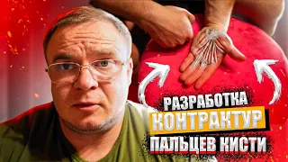 РАЗРАБОТКА  ПАЛЬЦЕВ КИСТИ после Переломов | Доктор Юршин