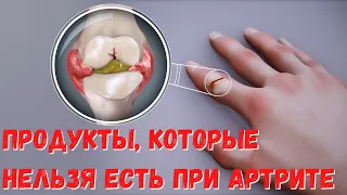 Какие продукты нельзя есть при артрите