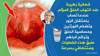 أهم ماتفعله ضدالتهاب الحلق مكونات تعالج احتقان الزورالتهاب الصدرالكحة تضخم اللوزتين التخلص من البلغم