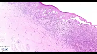 Skin Melanoma Microscopy - Talking slide