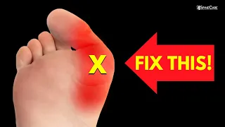 How to Relieve Bunion Pain at Home (NO EQUIPMENT!)