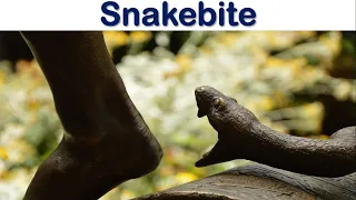 Snakebite Emergencies: When Seconds Count | First AID and Treatment