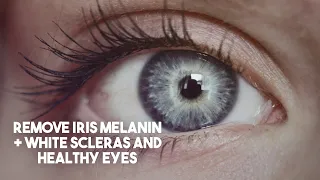 ∞ Remove Iris Melanin + White Scleras and Healthy Eyes ~ EXTREMELY POWERFUL 8D+ SUBLIMINAL [Day]