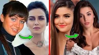 Turkish actresses before and after plastic surgery. Actresses without makeup