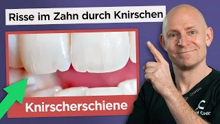 Die richtige Knirscherschiene gegen Zähneknirschen (Bruxismus)