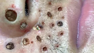 Make Your Day Satisfying with An Popping New Videos #11